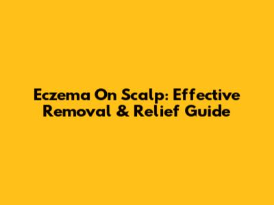 Eczema On Scalp: Effective Removal & Relief Guide