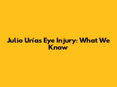 Julio Urías' Eye Injury: What We Know