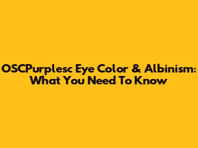 OSCPurplesc Eye Color & Albinism: What You Need To Know