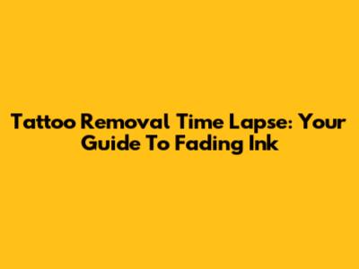 Tattoo Removal Time Lapse: Your Guide To Fading Ink