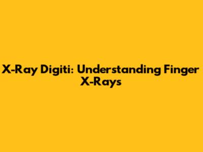 X-Ray Digiti: Understanding Finger X-Rays